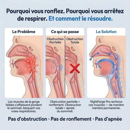 NightForge Pro — Entraînement des muscles de la gorge — Élimine définitivement le ronflement et l'apnée du sommeil